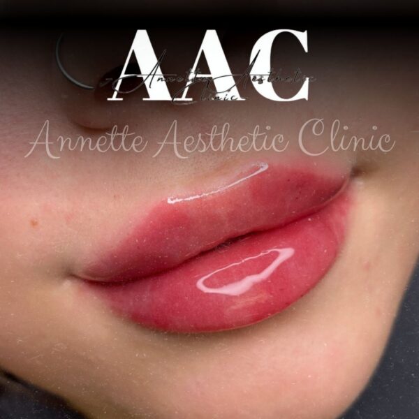 486448425_607090145666126_7396806863312458367_n