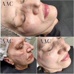 Face - Image 2