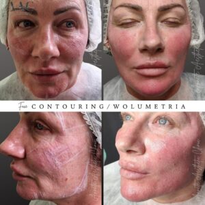 Face - Image 1