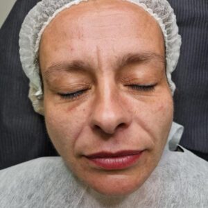 Face - Image 3