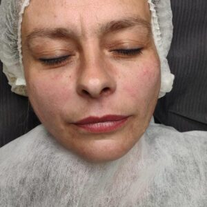 Face - Image 4